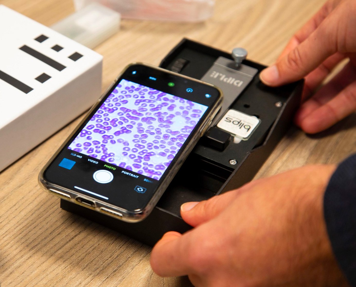 DIPLE Turns Your Smartphone or Tablet into a Powerful Microscope